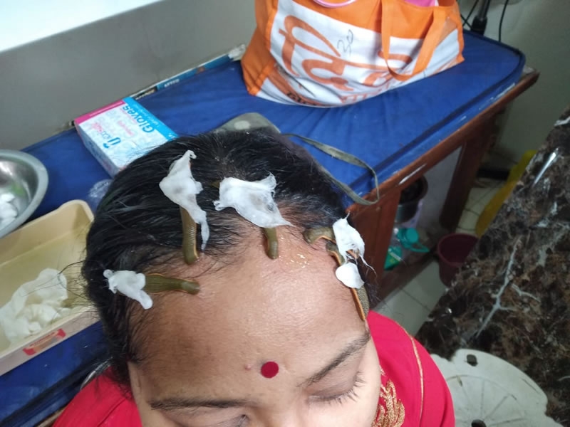 Saavi Ayurvedas Hair-Skin Care and Panchakarma Centre   